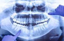 Radiografía Digital - Instalaciones Clínica Dental Madrid Centro Bordonclinic