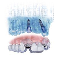Tecnología E Innovación Simplant System - Implantología Madrid - Instalaciones Clínica Dental Madrid Centro Bordonclinic