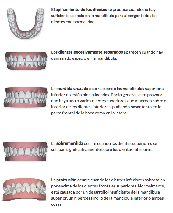 Problemas que resuelve invisalign Problemas que resuelve invisalign