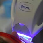 Blanqueamiento Dental Laser