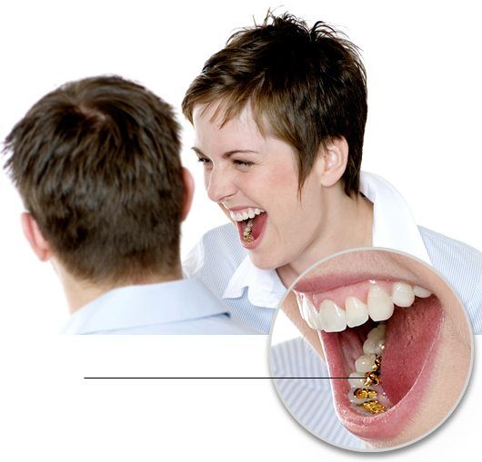 Ortodoncia Lingual Madrid - Brackets Linguales Sistema Incógnito TM