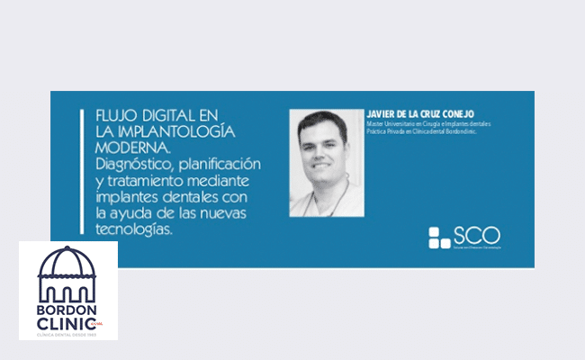 Flujo digital en Implantologia Moderna Clinica Dental en Madrid Bordonclinic