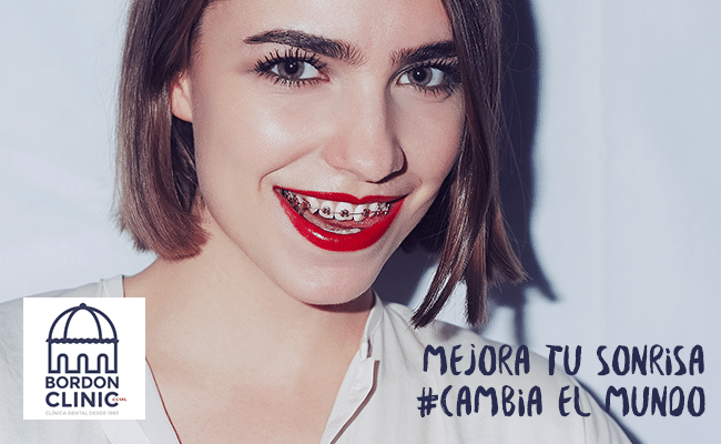ortodoncia invisalign para adultos Clinica Dental en Madrid Bordonclinic
