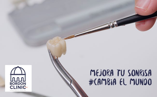 Corona Dental Corona Dental Clínica Dental Madrid Bordonclinic