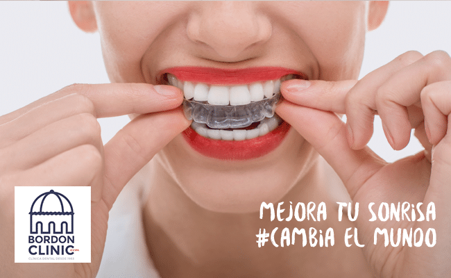 precio de ortodoncia invisible Invisalign Clínica dental Madrid Bordonclinic