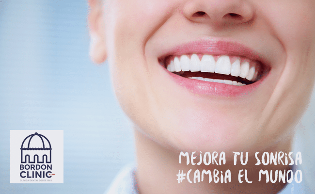 Periodontitis crónica Clinica Dental en Madrid Bordonclinic