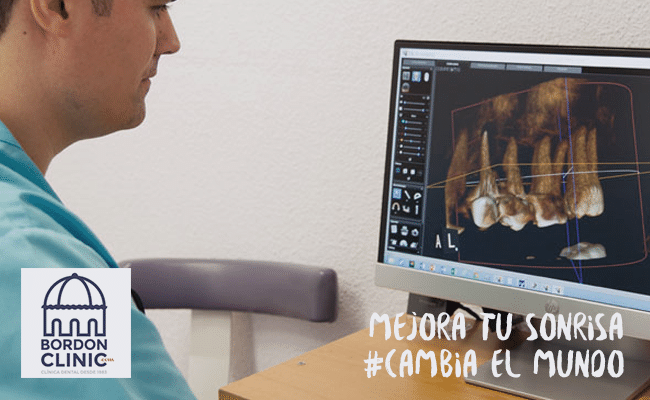 clínica dental con Tac 3D Clinica dental Madrid Bordonclinic