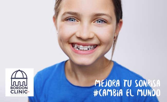 fases de una ortodoncia BORDONCLINIC