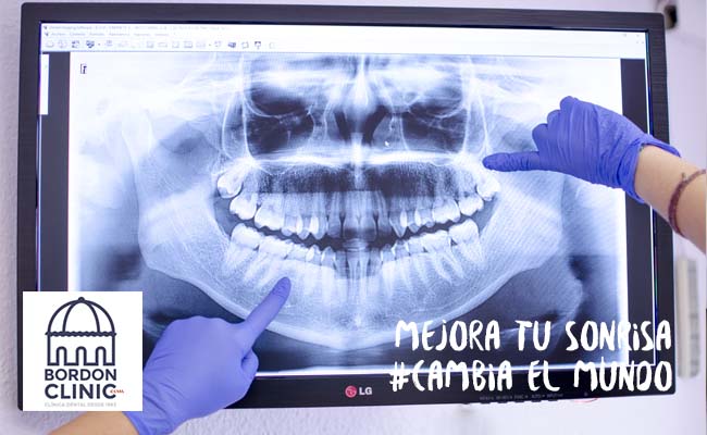radiografías dentales
