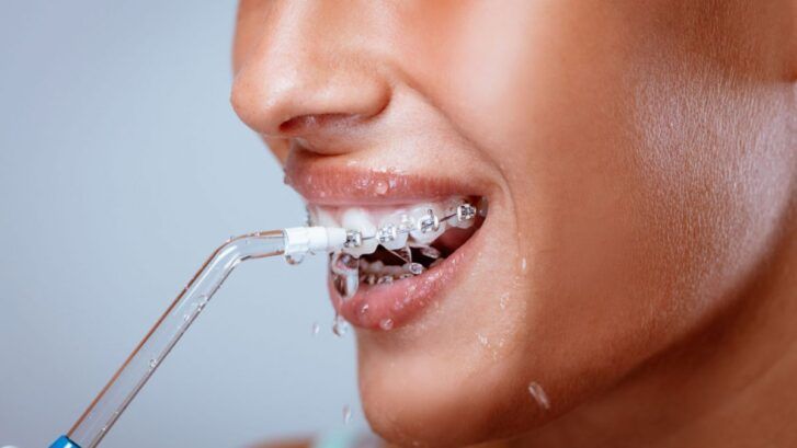 Irrigador dental, ¿qué es y qué beneficios aporta? - Clínica Dental BordonClinic