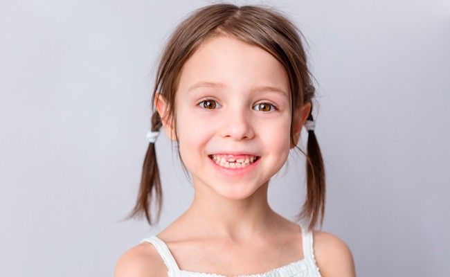 Dientes de leche ¿cuándo caen y salen los definitivos? - BordonClinic