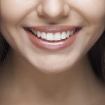 cómo blanquear los dientes