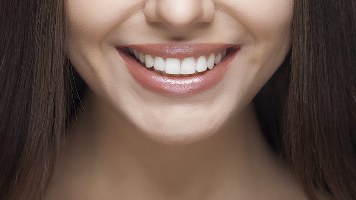 cómo blanquear los dientes