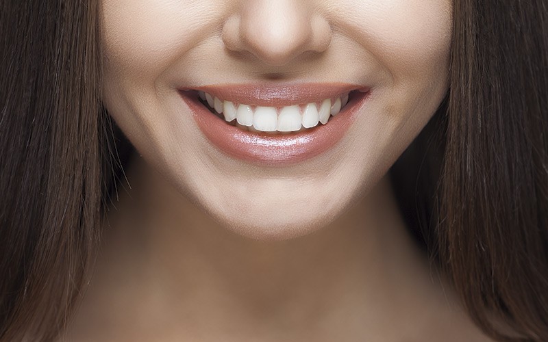 Cómo blanquear los dientes: consejos imprescindibles