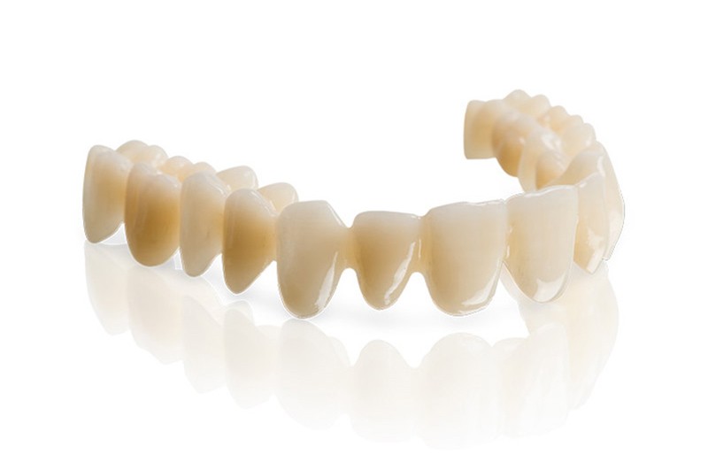 Puente Dental PMMA - Material Protesis Dental
