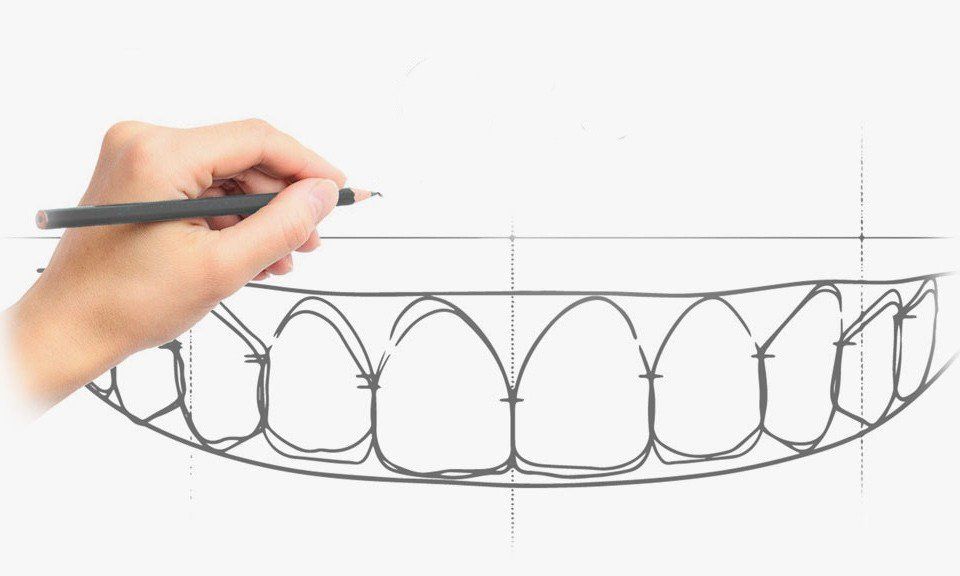 Estética Dental - Bordonclinic
