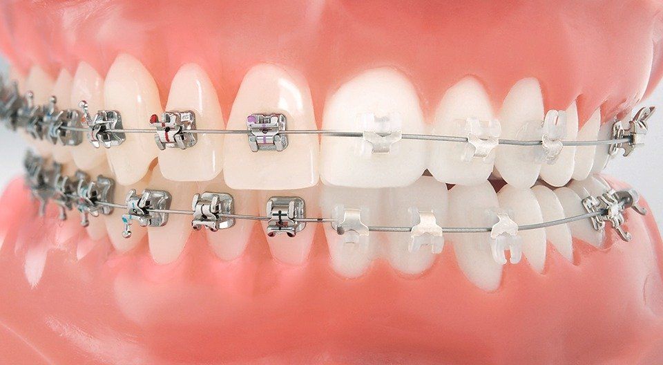 Brackets Brackets Precio