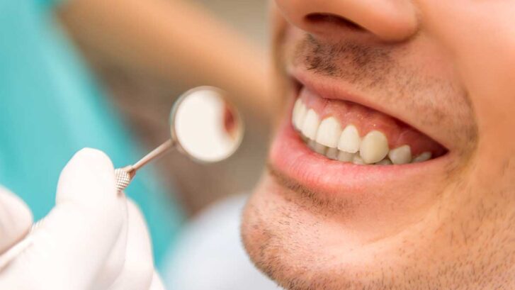 Sonrisa gingival: causas y tratamiento