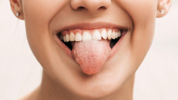 Picor En La Lengua: ¿Cuáles Son Sus Causas? - Clínica Dental Bordonclinic