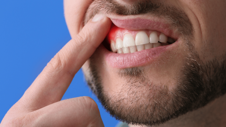 Enfermedades periodontales