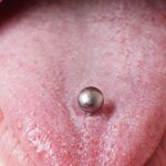 5 Modas Dentales Peligrosas