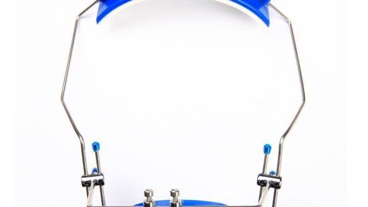 Máscara Facial De Ortodoncia: ¿en Qué Consiste? Máscara Facial De Ortodoncia: ¿en Qué Consiste? - Clínica Dental BordonClinic